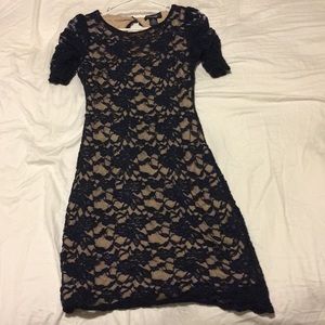 Blue Lace Mini Dress